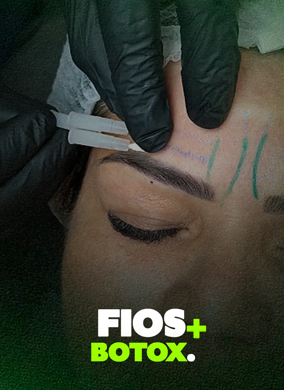 Fios